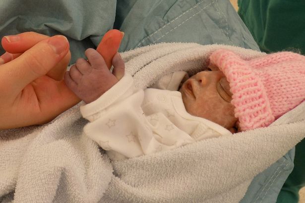 I genitori donano i reni della figlia neonata affetta da ancefalia