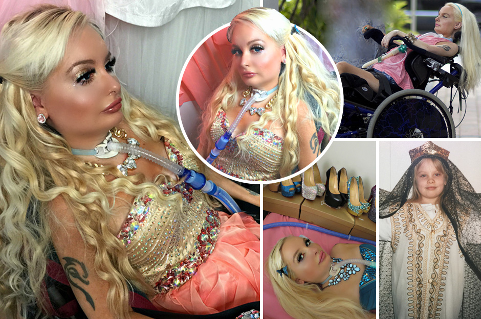 Tetraplegica diventa la prima Barbie umana, ecco perchè